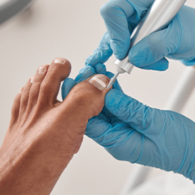 Fusswerk Kerken – BS-Spange